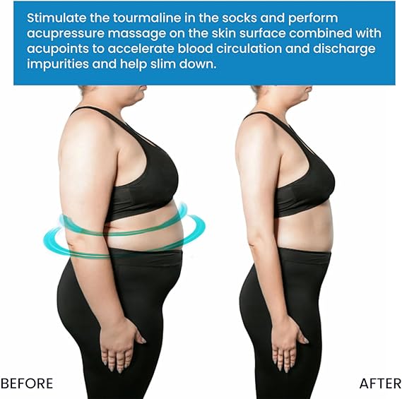 Pilates-gribesokker Skridsikre yoga- og barre-sokker