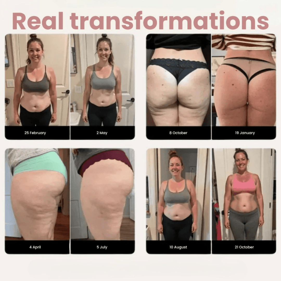 Sømløse anti-cellulite leggings